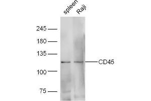 Western Blotting (WB) image for anti-Protein tyrosine Phosphatase, Receptor Type, C (PTPRC) (AA 1210-1304) antibody (ABIN669606)