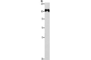 Western Blotting (WB) image for anti-Ellis Van Creveld Syndrome 2 (EVC2) antibody (ABIN2433002) (EVC2 anticorps)