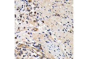 Immunohistochemistry of paraffin-embedded human colon using MCM2 antibody (ABIN5970415) at dilution of 1/200 (40x lens). (MCM2 anticorps)