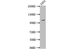 Western Blot Positive WB detected in: U251 whole cell lysate All lanes: MME antibody at 1:1500 Secondary Goat polyclonal to rabbit IgG at 1/50000 dilution Predicted band size: 86 kDa Observed band size: 100 kDa (Recombinant MME anticorps)