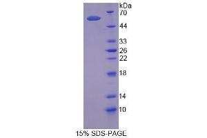 SDS-PAGE (SDS) image for TNF Receptor-Associated Factor 1 (TRAF1) (AA 131-381) protein (His tag,GST tag) (ABIN4990499) (TRAF1 Protein (AA 131-381) (His tag,GST tag))