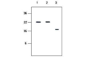 Human recombinant protein kIR2DL1, kIR2DL3 and kIR2DL4 (each 20ng per well) were resolved by SDS-PAGE, transferred to PVDF membrane and probed with anti-human kIR2D (1:500). (KIR2D anticorps  (AA 44-202))