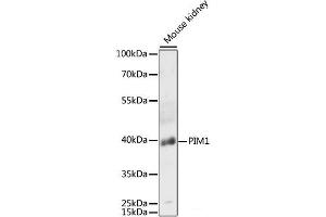 Western blot analysis of extracts of Mouse kidney using PIM1 Polyclonal Antibody at dilution of 1:3000. (PIM1 anticorps)