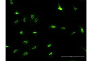Immunofluorescence of monoclonal antibody to DLX3 on HeLa cell. (DLX3 anticorps  (AA 1-287))