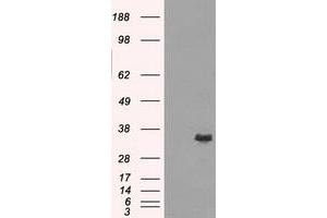 Image no. 3 for anti-Aldo-Keto Reductase Family 1, Member A1 (Aldehyde Reductase) (AKR1A1) antibody (ABIN1496542) (AKR1A1 anticorps)