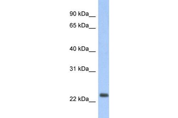 MT-ND6 anticorps  (Middle Region)