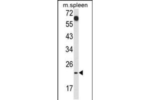 Western blot analysis of CD7 Antibody in mouse spleen tissue lysates (35ug/lane) (CD7 anticorps  (AA 65-91))