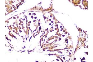 Immunohistochemistry of paraffin-embedded rat testis using UCHL3 Rabbit mAb (ABIN1682628, ABIN3015461, ABIN3015462 and ABIN7101429) at dilution of 1:100 (40x lens). (UCHL3 anticorps)