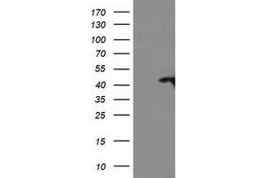 Western Blotting (WB) image for anti-TBC1 Domain Family, Member 21 (TBC1D21) antibody (ABIN1501312) (TBC1D21 anticorps)