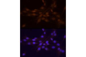 Immunofluorescence analysis of PC-12 cells using Chk1 Rabbit pAb (ABIN6134818, ABIN6138518, ABIN6138519 and ABIN6223572) at dilution of 1:25 (40x lens). (CHEK1 anticorps)