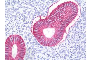 Anti-ESA / EPCAM antibody IHC staining of human uterus, endometrium. (EpCAM anticorps)