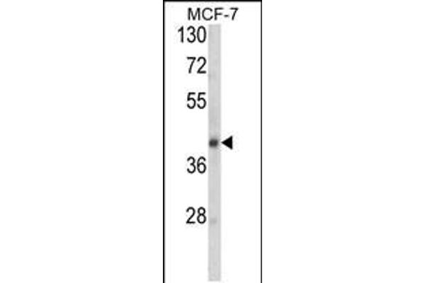 SERPINA9 anticorps  (AA 194-222)