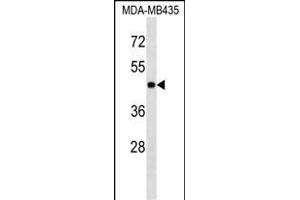 PK3 Antibody (ABIN1539804 and ABIN2843791) western blot analysis in MDA-M cell line lysates (35 μg/lane). (ERK1 anticorps)
