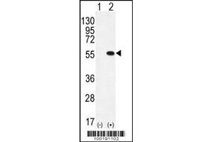 Western blot analysis of PRMT2 using rabbit polyclonal PRMT2 Antibody (L359) using 293 cell lysates (2 ug/lane) either nontransfected (Lane 1) or transiently transfected (Lane 2) with the PRMT2 gene. (PRMT2 anticorps  (C-Term))