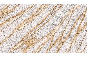 Human skeletal muscle: immunohistochemical staining on a frozen longitudinal section. (Dystroglycan anticorps  (C-Term))