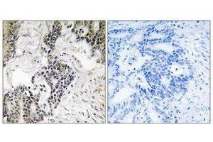 Immunohistochemistry (IHC) image for anti-Cell Division Cycle 25 Homolog C (S. Pombe) (CDC25C) (pSer198) antibody (ABIN1847751) (CDC25C anticorps  (pSer198))