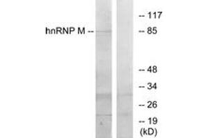 Western blot analysis of extracts from HT-29 cells, using hnRNP M Antibody. (HNRNPM anticorps  (AA 11-60))