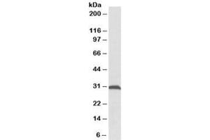 Western blot testing of rat skeletal muscle lysate with ATPG antibody at 0. (ATPG anticorps)