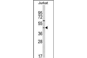 Western blot analysis of PTAR1 Antibody in Jurkat cell line lysates (35ug/lane) (PTAR1 anticorps  (AA 60-89))