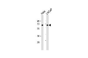 All lanes : Anti-MYC Antibody at 1:1000 dilution Lane 1: Hela whole cell lysate Lane 2: LNCaP whole cell lysate Lysates/proteins at 20 μg per lane. (c-MYC anticorps  (AA 351-380))