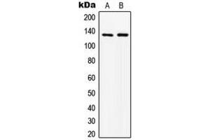 Western blot analysis of ABL1 expression in MCF7 (A), HepG2 (B) whole cell lysates. (ABL1 anticorps  (N-Term))