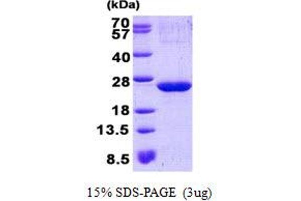 ARPC3 Protein (His tag)