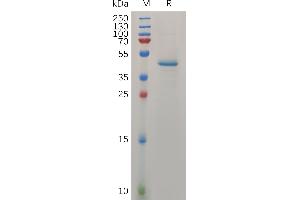 Human MDK Protein, hFc Tag on SDS-PAGE under reducing condition. (Midkine Protein (AA 21-143) (Fc Tag))