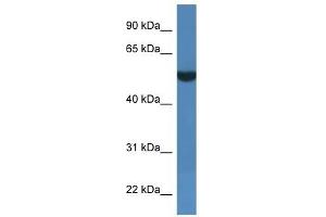 Western Blot showing FSD1L antibody used at a concentration of 1 ug/ml against THP-1 Cell Lysate (FSD1L anticorps  (C-Term))