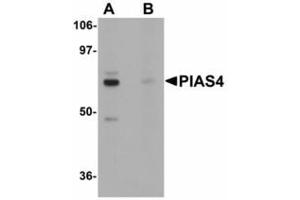 Image no. 1 for anti-Protein Inhibitor of Activated STAT, 4 (PIAS4) (N-Term) antibody (ABIN478293) (PIAS4 anticorps  (N-Term))
