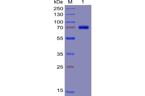 TIM3 Protein (AA 22-202) (mFc-His Tag)