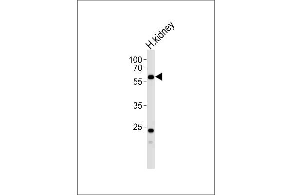 PFKFB3 anticorps  (C-Term)