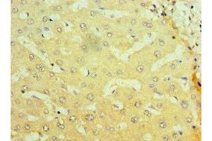 Immunohistochemistry of paraffin-embedded human liver tissue using ABIN7161897 at dilution of 1:100 (NR1I2 anticorps  (AA 175-434))