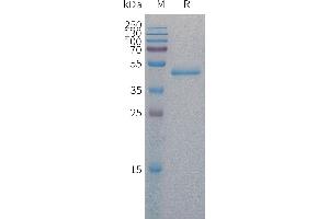 PAI1 Protein (AA 24-402) (His tag)