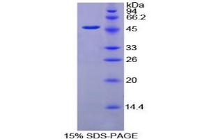 SDS-PAGE analysis of Chicken Fibrinogen gamma Protein. (FGG Protéine)
