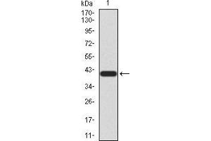 Western Blotting (WB) image for anti-Neurotrophic Tyrosine Kinase, Receptor, Type 2 (NTRK2) (AA 207-339) antibody (ABIN5873038) (TRKB anticorps  (AA 207-339))
