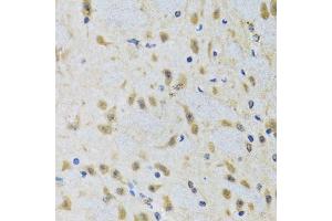 Immunohistochemistry of paraffin-embedded rat brain using ATG7 antibody. (ATG7 anticorps  (AA 500-676))