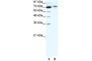 C14ORF101 antibody used at 5 ug/ml to detect target protein. (C14orf101 anticorps  (N-Term))