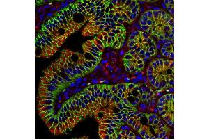 Immunohistochemistry (IHC) image for anti-Catenin (Cadherin-Associated Protein), beta 1, 88kDa (CTNNB1) (N-Term) antibody (ABIN2855042)