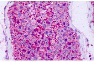 Anti-NPFF2 / NPFFR2 antibody IHC staining of human testis. (NPFFR2 anticorps  (C-Term))