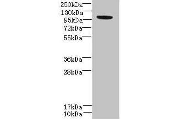 PPFIBP2 anticorps  (AA 101-400)