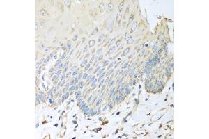 Immunohistochemistry of paraffin-embedded human esophagus using SGCB antibody. (SGCB anticorps)