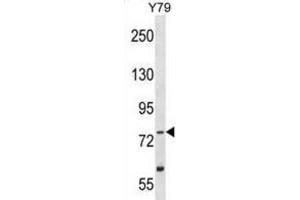 Western Blotting (WB) image for anti-Tousled-Like Kinase 2 (TLK2) antibody (ABIN2995273) (TLK2 anticorps)