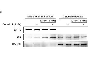 Western Blotting (WB) image for anti-Sequestosome 1 (SQSTM1) antibody (ABIN2854836)