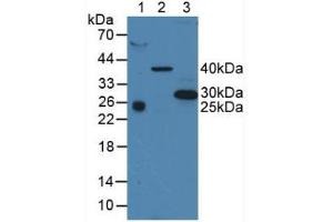 Western blot analysis of (1) Human Serum, (2) Porcine Liver Tissue and (3) Human A375 Cells. (CD63 anticorps  (AA 103-203))