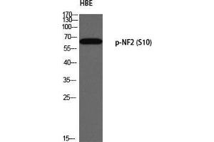 Western Blot (WB) analysis of HBE using p-NF2 (S10) antibody. (Merlin anticorps  (pSer10))