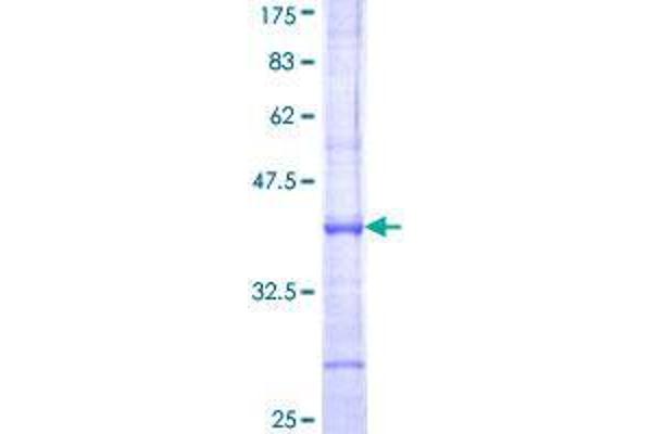 SENP1 Protein (AA 544-643) (GST tag)