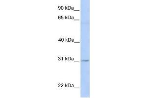 Western Blotting (WB) image for anti-Membrane-Associated Ring Finger (C3HC4) 2, E3 Ubiquitin Protein Ligase (MARCH2) antibody (ABIN2458695) (MARCH2 anticorps)