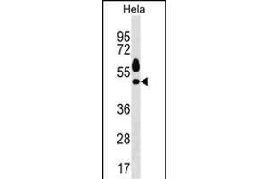 Mouse Sgk1 Antibody (C-term) (ABIN1537130 and ABIN2850307) western blot analysis in Hela cell line lysates (35 μg/lane). (SGK1 anticorps  (C-Term))