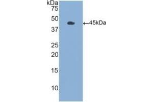 Detection of Recombinant GMCSF, Human using Polyclonal Antibody to Colony Stimulating Factor 2, Granulocyte Macrophage (GM-CSF) (GM-CSF anticorps  (AA 18-144))