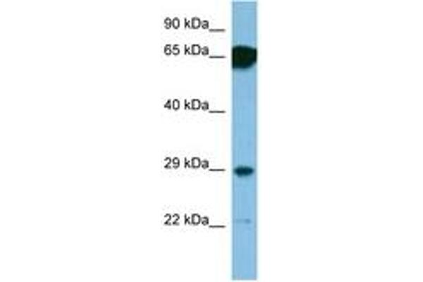 SNRPN anticorps  (AA 46-95)